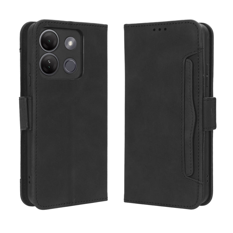 For Infinix Smart 7 HD X6516 Skin Feel Calf Texture Card Slots Leather Phone Case(Black) - Infinix Cases by buy2fix | Online Shopping UK | buy2fix